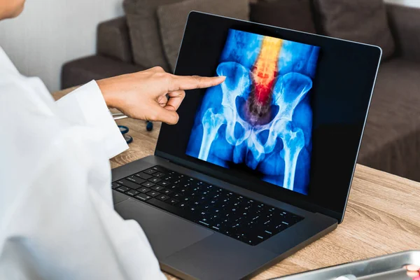 Doctor looking a x-ray of pain in the spine. Backache trauma. High quality photo