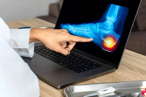 Close up of doctor showing a x-ray of foot. Pain heel and foot injury. High quality photo