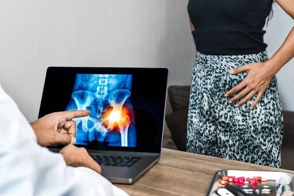 Doctor showing a x-ray of pain in the hips on a laptop. Woman patient in the background. High quality photo