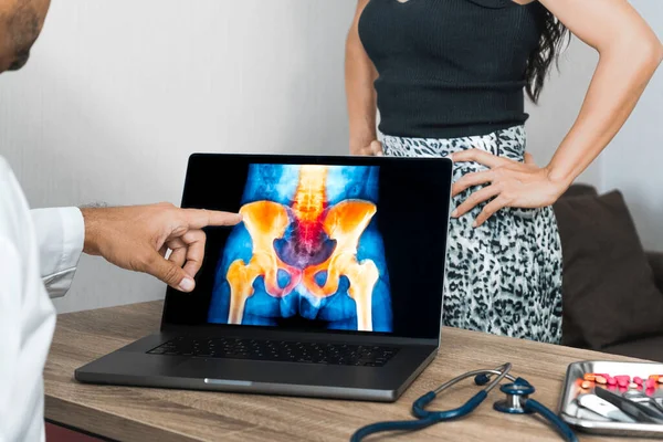 Doctor showing a x-ray of pain in the hips on a laptop. Woman patient in the background. High quality photo