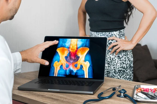 Doctor showing a x-ray of pain in the hips on a laptop. Woman patient in the background. High quality photo