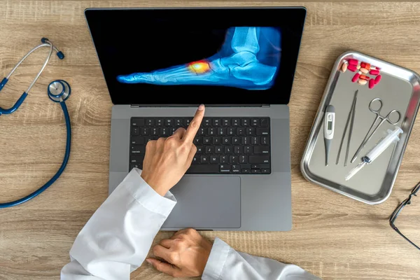 Top view of doctor showing a x-ray of foot. Pain injury. High quality photo