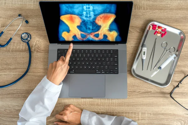 Top view of doctor showing a x-ray of pain in the hips on a laptop. . High quality photo