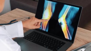 Kadın doktor dizlerinde ve dizlerinde ağrı olan bir röntgen filmi gösteriyor. Omzunun üstünden bak. Yüksek kalite 4k görüntü