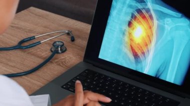 Kadın doktor dizüstü bilgisayarda göğüs röntgeni çekiyor. Kalp krizi konsepti. Yüksek kalite 4k görüntü