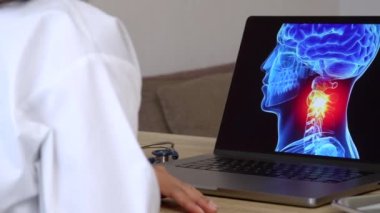 Dizüstü bilgisayarında boynundaki ağrının röntgenini gösteren bir kadın doktorun eli yakın çekim. Migren ağrısı konsepti. Soldan sağa atış. Yüksek kalite 4k görüntü