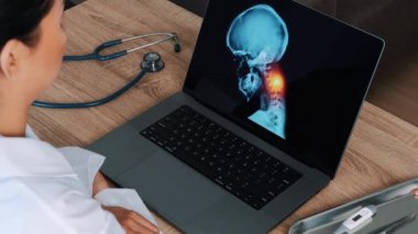 Kadın doktor dizüstü bilgisayarda boyun röntgenini gösteriyor. Migren ağrısı konsepti. Yüksek kalite 4k görüntü