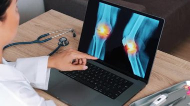 Woman Doctor showing x-ray with pain in the knees on a laptop. View above the shoulder. High quality 4k footage