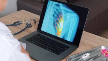 Woman Doctor showing x-ray with pain on the ribs on a laptop. View over the shoulder slow motion. High quality 4k footage