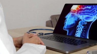 Close up of hands of a woman doctor showing a x-ray of brain on a laptop. Migraine headache concept. High quality 4k footage