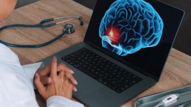 Woman doctor showing a x-ray of pain in the brain on a laptop. View above the shoulder. High quality 4k footage