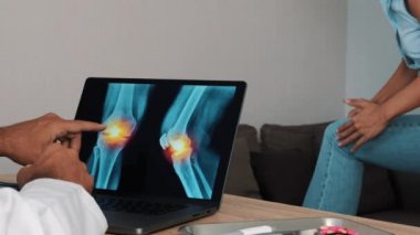 Doctor showing x-ray of pain in the knees on a laptop with woman patient. High quality 4k footage