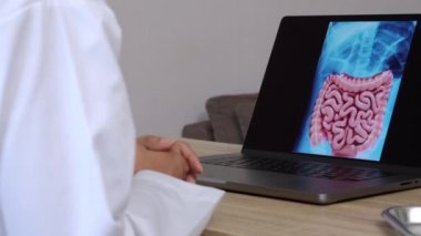 Close up of hand of a woman doctor showing a x-ray of stomach and intestine on a laptop. Right to left shot. High quality 4k footage