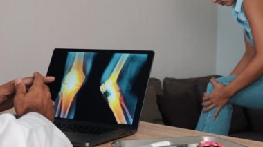 Doctor showing x-ray of pain in the knees on a laptop with woman patient. High quality 4k footage