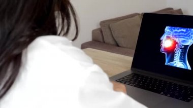 Woman doctor showing a x-ray of brain on a laptop. Migraine headache concept. Right to left shot. High quality 4k footage