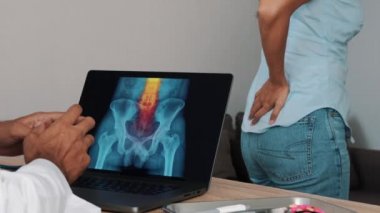 Doctor showing x-ray of pain in the lower spine in the back on a laptop with woman patient. High quality 4k footage