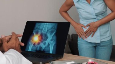 Doctor showing x-ray of pain in the side of hips on a laptop with woman patient. High quality 4k footage