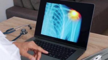 Woman Doctor showing x-ray with pain on the shoulder on a laptop. Slow motion. High quality 4k footage