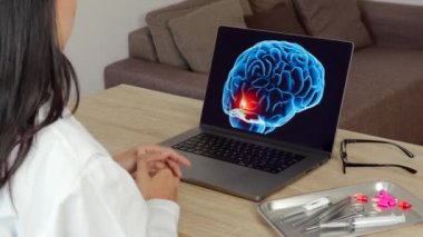 Woman doctor showing a x-ray of brain on a laptop. Migraine headache concept. High quality 4k footage