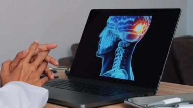 Close up of doctor showing a x-ray of skull with pain on the back of the brain on a laptop. High quality 4k footage