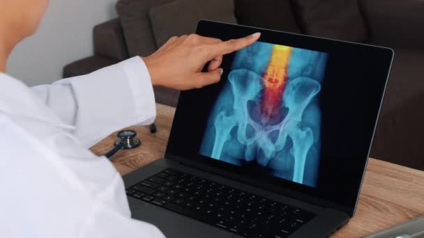 Kvinna Läkare Visar Röntgen Med Smärta Ryggraden Bärbar Dator Över — Stockvideo