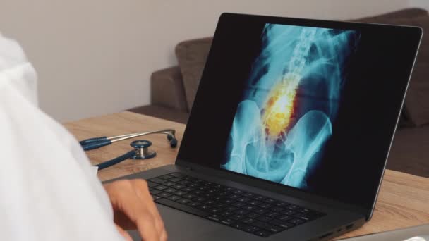 Kobieta Doktor Pokazuje Prześwietlenie Bólem Kręgosłupa Laptopie Wysokiej Jakości Materiał — Wideo stockowe