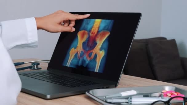 Ärztin Zeigt Röntgenbild Mit Schmerzen Hüfte Und Wirbelsäule Auf Laptop — Stockvideo
