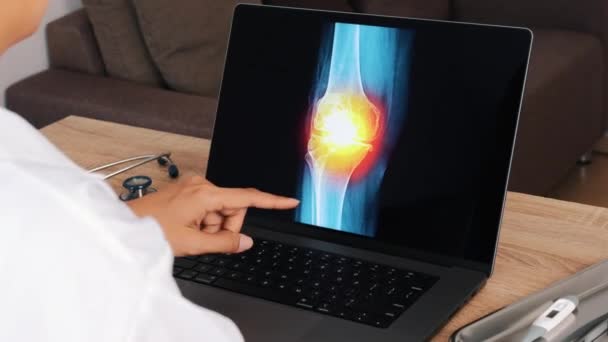 Γυναίκα Γιατρός Δείχνει Ακτινογραφία Πόνο Στο Γόνατο Ένα Φορητό Υπολογιστή — Αρχείο Βίντεο