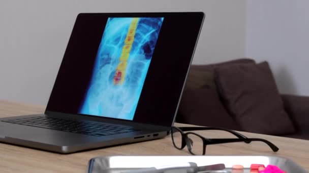 Крупный План Руки Женщины Врача Показывающей Рентген Позвоночника Ноутбуке Справа — стоковое видео
