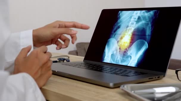 Hand Woman Doctor Showing Ray Pain Spine Laptop Right Left — Stock video