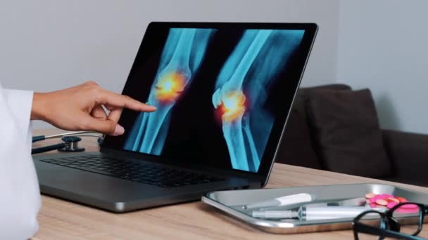 Woman Doctor Showing Ray Pain Knees Laptop Left Right Shot — Stockvideo