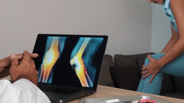 Doctor Showing Ray Pain Knees Laptop Woman Patient High Quality — Stock video