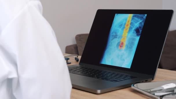 Доктор Женщина Показала Рентген Болью Позвоночнике Ноутбуке Медленное Движение Слева — стоковое видео