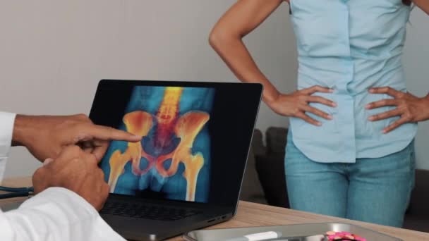 Doctor Showing Ray Pain Hips Laptop Woman Patient High Quality — Stok video