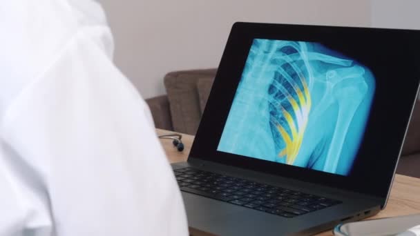 Woman Doctor Showing Ray Pain Ribs Laptop Left Right Shot — Stock video