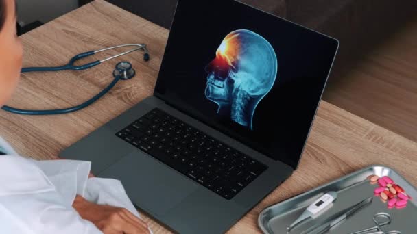 Woman Doctor Showing Ray Skull Pain Forehead Laptop View Shoulder — Vídeo de Stock