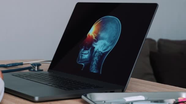 Жінка Лікар Показує Рентген Черепа Болем Лобі Ноутбуці Зліва Направо — стокове відео