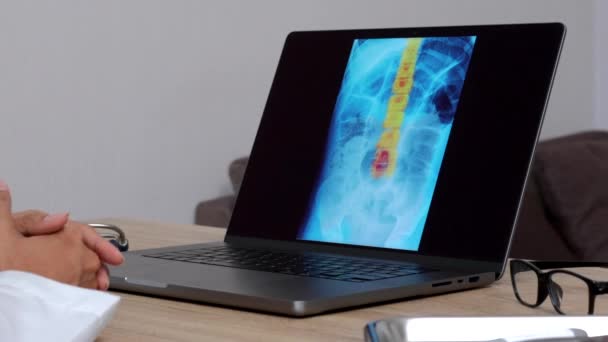 Hand Woman Doctor Showing Ray Spine Laptop Close Shot High — Stock video