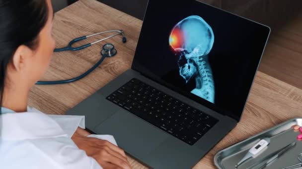 Жінка Лікар Показує Рентген Черепа Болем Лобі Ноутбуці Концепція Мігрені — стокове відео