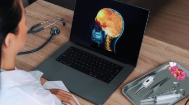Woman doctor showing a x-ray of skull with pain in the brain on a laptop. Migraine headache concept. High quality 4k footage