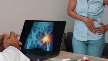 Doctor showing x-ray of pain in the side of hips on a laptop with woman patient. High quality 4k footage