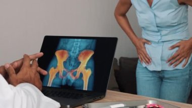 Doctor showing x-ray of pain in the hips on a laptop with woman patient. High quality 4k footage