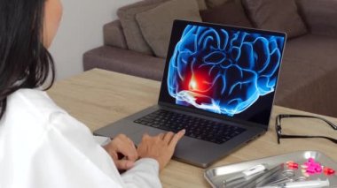 Woman doctor zooming in a x-ray of brain on a laptop. Migraine headache concept. High quality 4k footage