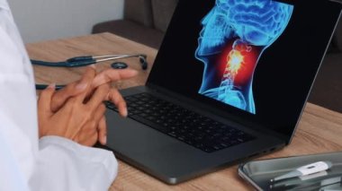 Close up of doctor showing a x-ray of head with pain in the neck on a laptop. High quality 4k footage