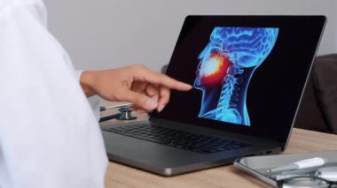 Woman Dentist showing x-ray with pain in the mouth on a laptop. Slow Motion. High quality 4k footage