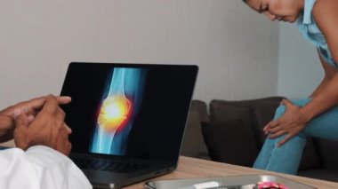Doctor showing x-ray of pain in a knee on a laptop with woman patient. High quality 4k footage