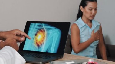Doctor showing x-ray of pain in the heart on a laptop with woman patient. Heart attack symptoms. High quality 4k footage