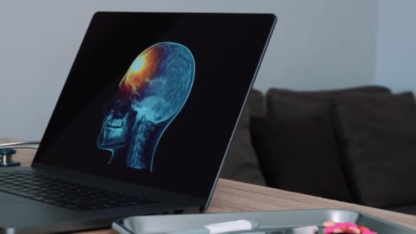 Woman Doctor Showing Ray Skull Pain Forehead Laptop Right Left — 图库视频影像
