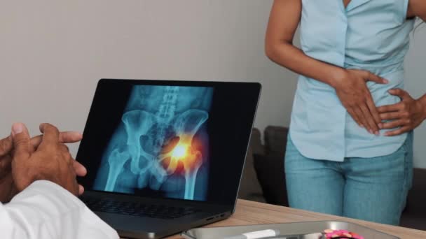 Лікар Показує Рентген Болю Боці Стегон Ноутбуці Пацієнткою Високоякісні Кадри — стокове відео