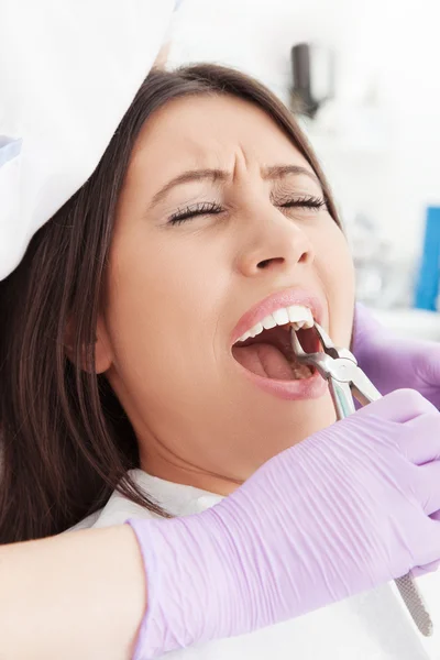 Dentista extraindo o dente — Fotografia de Stock